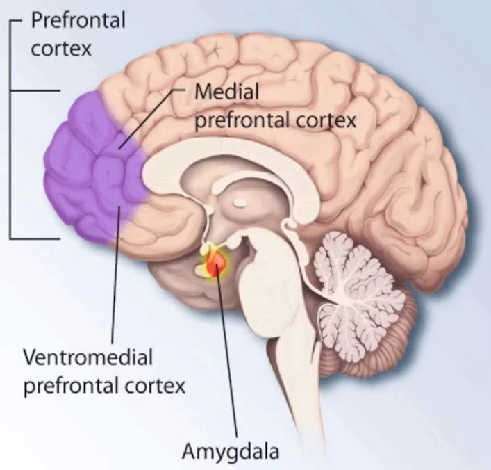 Diagram of the human brain highlighting the prefrontal cortex, medial prefrontal cortex, ventromedial prefrontal cortex, and amygdala.